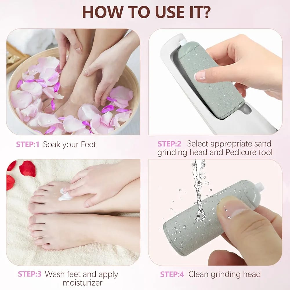 Rechargeable Callus Remover