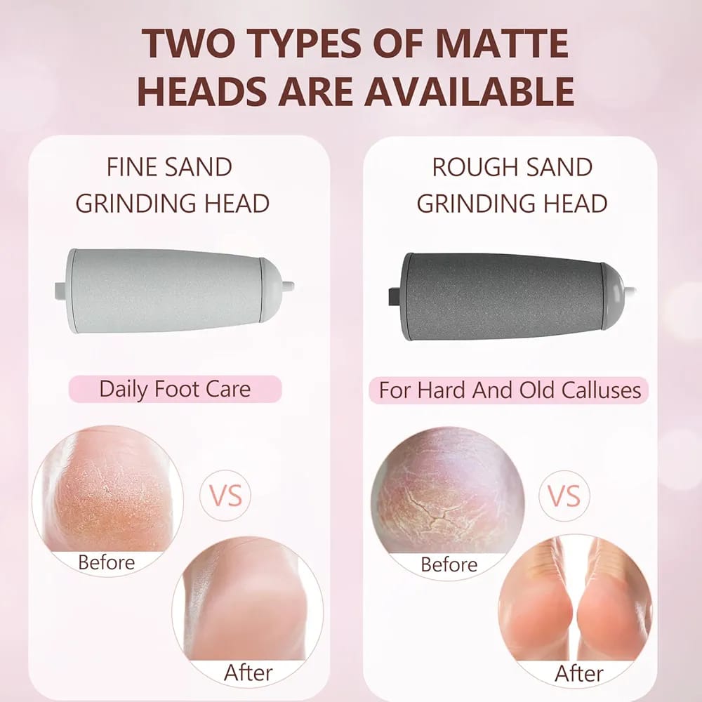 Rechargeable Callus Remover